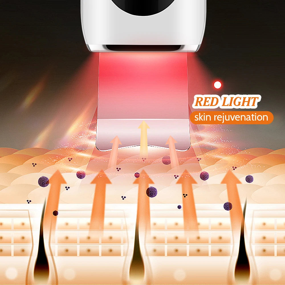 EXTRACTION POINT NOIR NEZ ET VISAGE-PURCLEAN ™ - Figia Shop